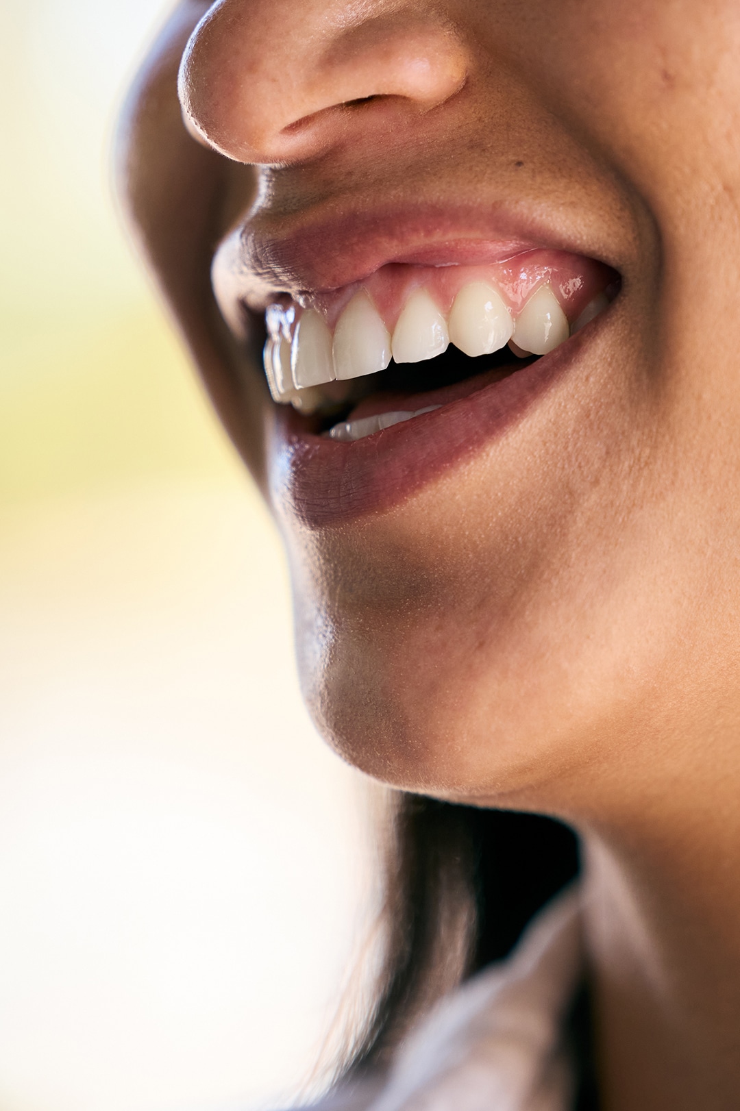 A close up of a young woman's smile after dental appointment at esteem dental studio