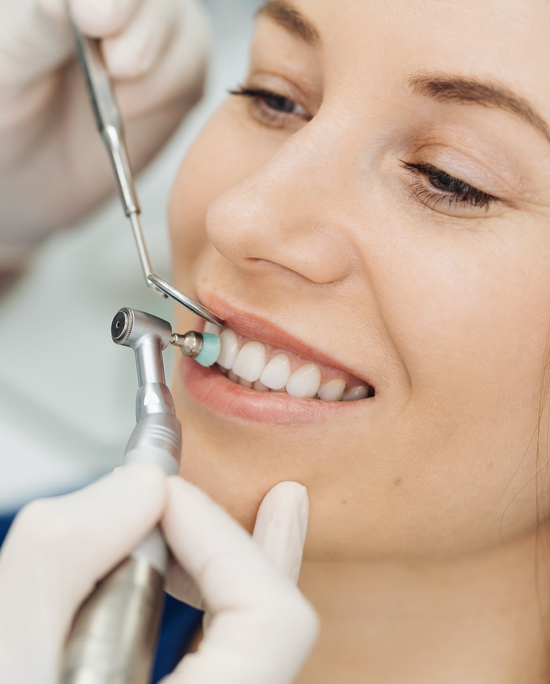 A close up of a young woman getting her teeth polished by a dentist at esteem dental studio